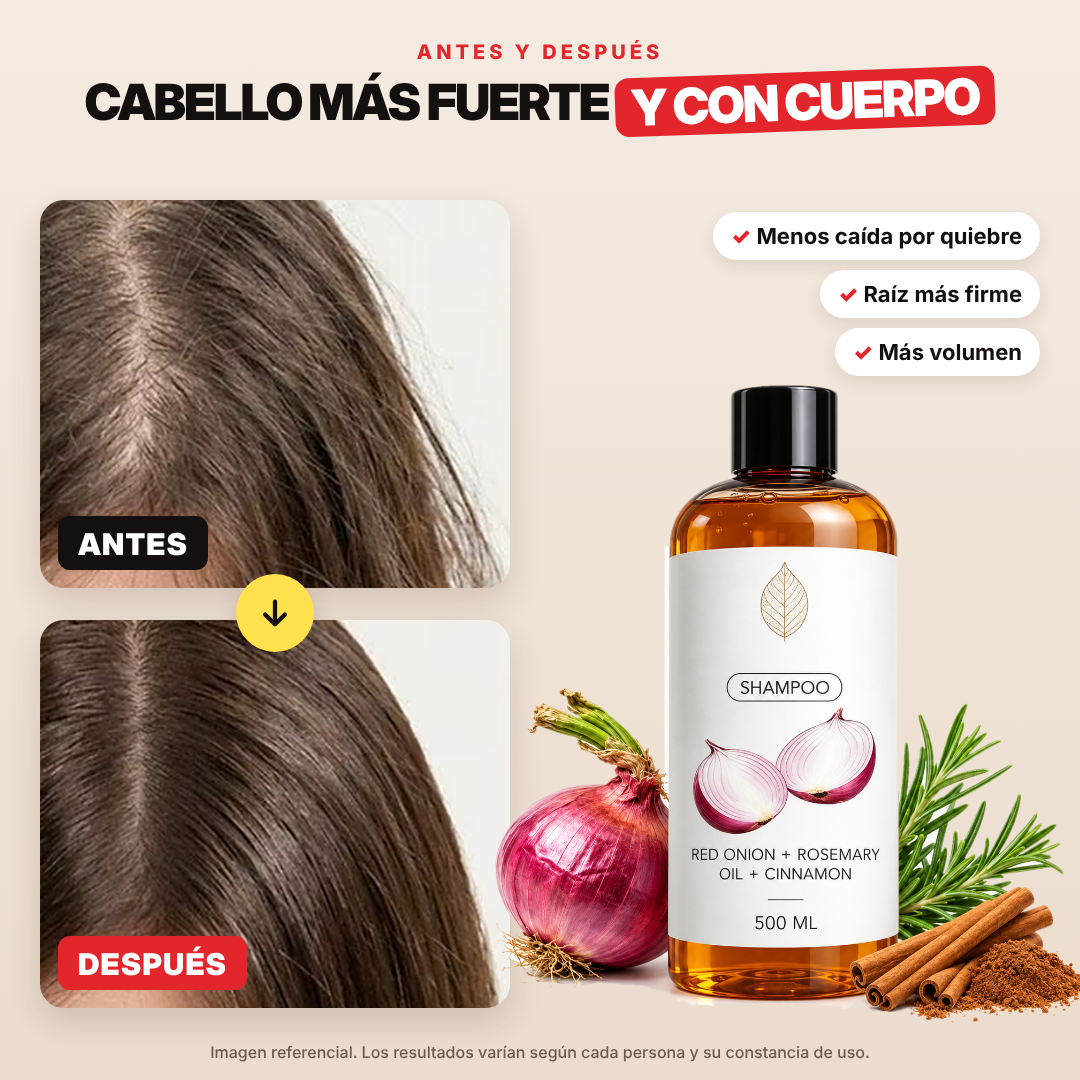 SHAMPOO EXCALVO 500ML | VUELVE A TENER LA FIRMESA DE ANTES